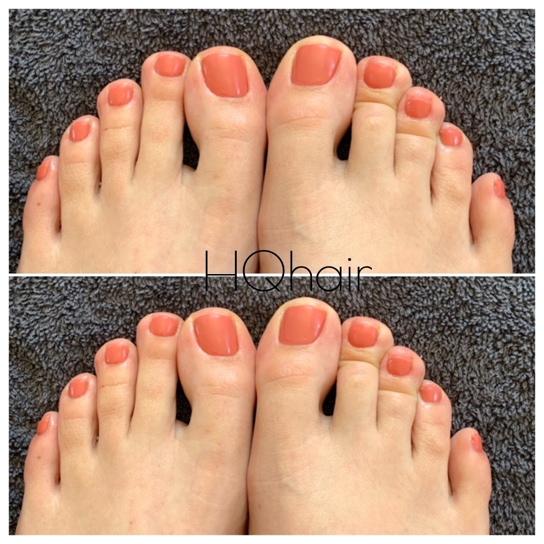 thumbnail_image1